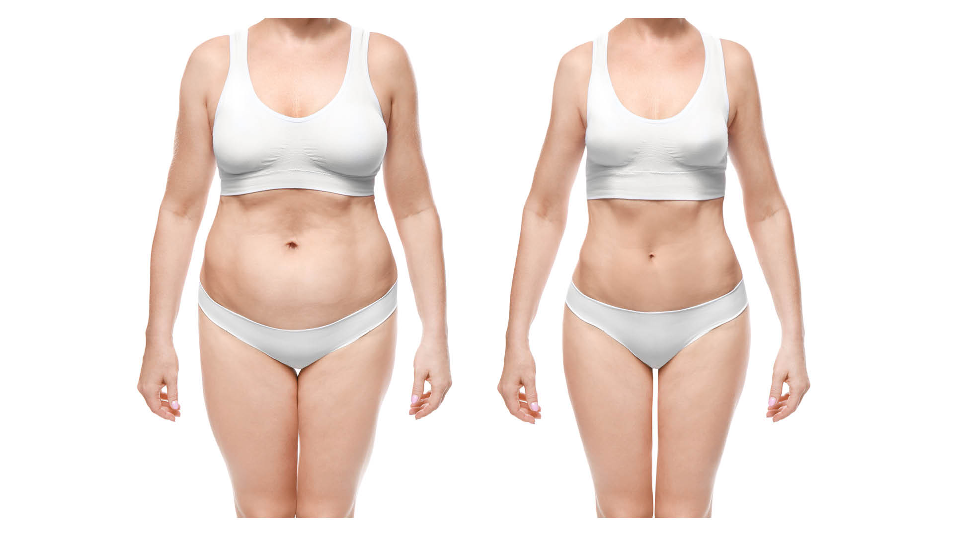 résultat avant-après 