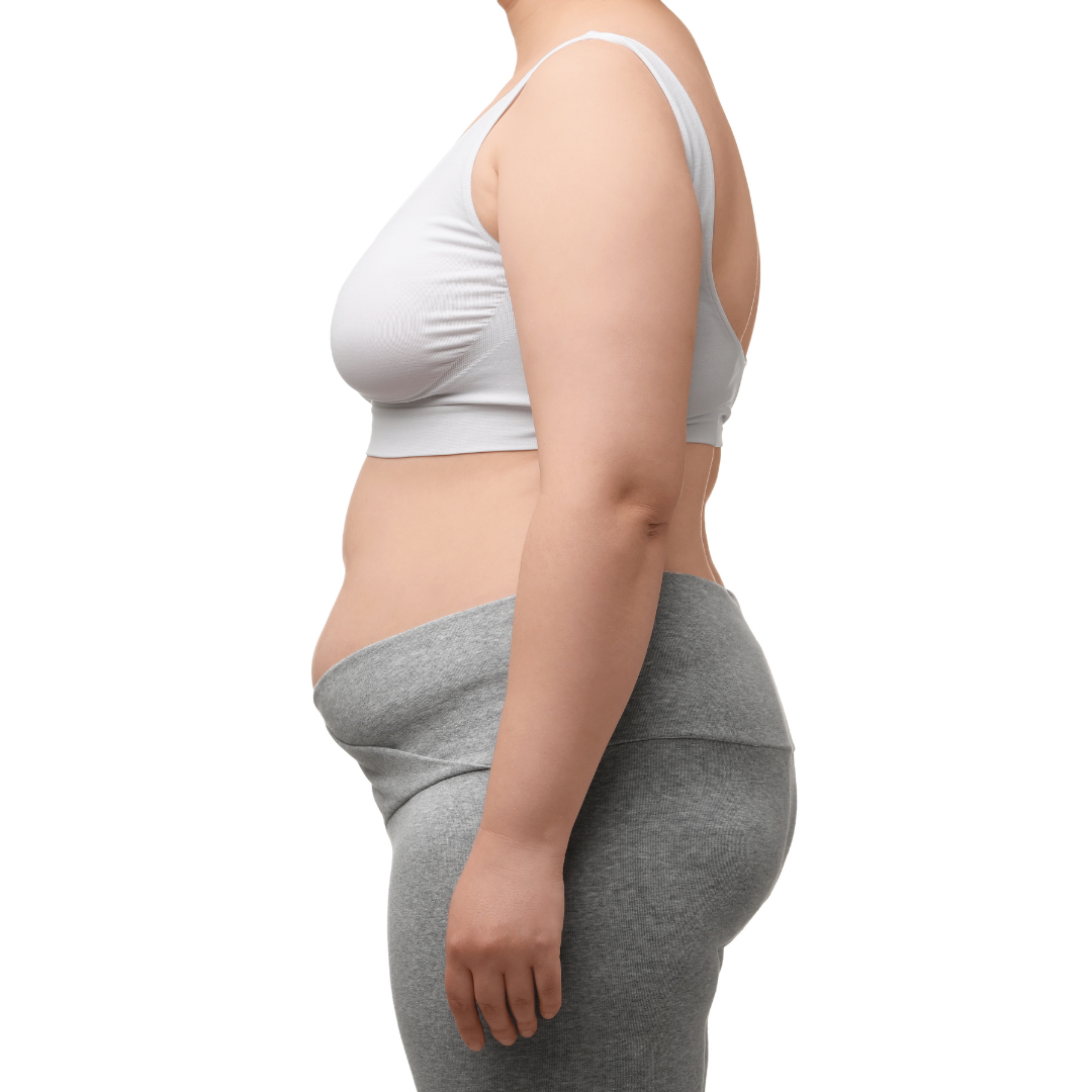 femme en surpoid de profil